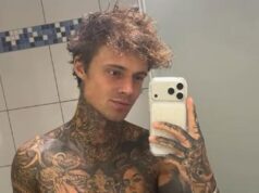 Atualização pós-cirurgia: Samuel Dohmen XXL compartilhou uma foto da lesão