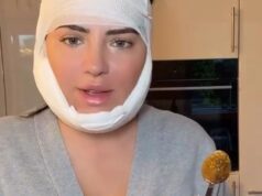 Exemplo? Leela Heiter foi duramente criticada após a cirurgia estética