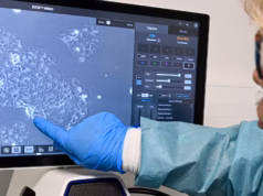 Novos medicamentos para câncer de pâncreas mostram promessa especial para doenças mortais