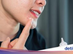 O Benzolac é realmente eficaz no tratamento de acne e manchas?