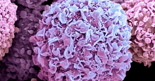 Os-efeitos-antitumorais-dos-medicamentos-do-tipo-Ozempic-sao-de.jpg