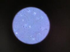 Primeira no mundo: paciente produz esperma a partir de tecido testicular criopreservado