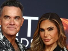 Robbie Williams mostra dente quebrado – piadas da esposa Ida Field