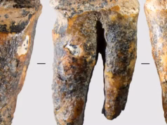 Sim, os Neandertais foram ao dentista!