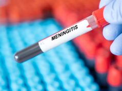Três casos de meningite, incluindo um fatal, foram relatados no sul da Inglaterra.