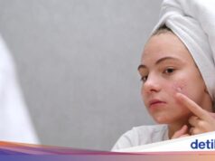 Tretinoína: benefícios, como usar e efeitos colaterais para acne e efeitos antienvelhecimento